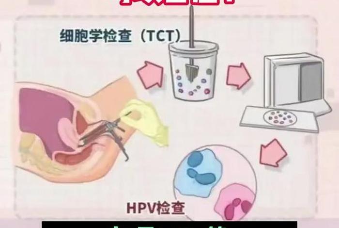 hpv伴侣、hpv伴侣间反复感染