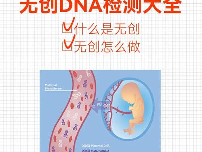 magento是什么意思，magnecure是什么意思