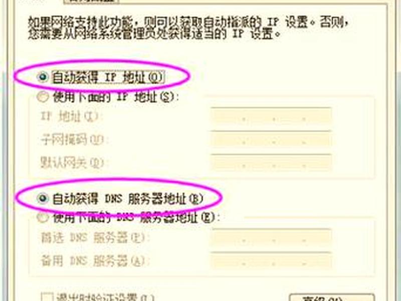 win 7怎么新建本地连接 - win7怎么新建本地连接 win 7怎么新建本地连接 - win7怎么新建本地连接