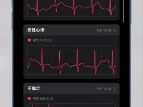 华为ECG功能使用；华为ecg功能使用