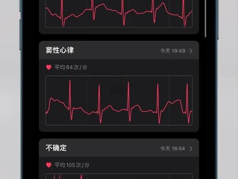 华为ECG功能使用;华为ecg功能使用 华为ECG功能使用;华为ecg功能使用
