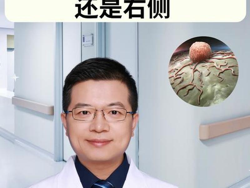 idc是什么、idc是什么乳腺癌 idc是什么、idc是什么乳腺癌