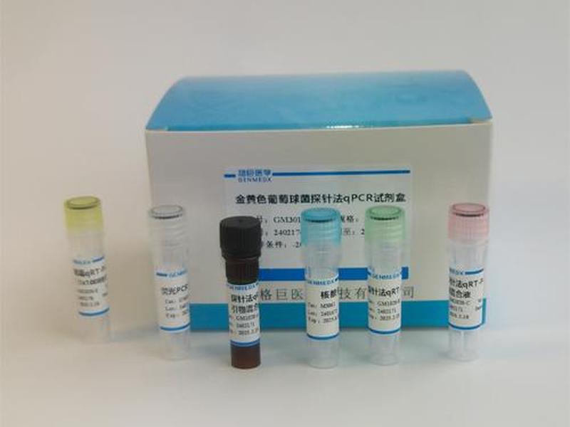 nat检测试剂盒(microrna检测试剂盒) nat检测试剂盒(microrna检测试剂盒)