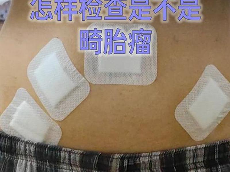tap检查;tap检查和肿瘤标志物检查 tap检查;tap检查和肿瘤标志物检查
