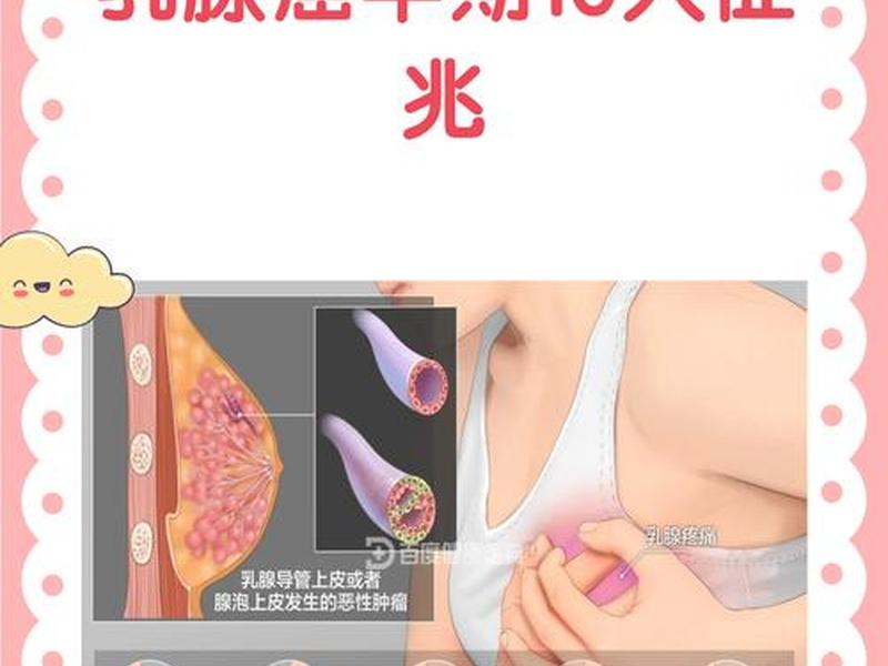 idc是什么、idc是什么乳腺癌 idc是什么、idc是什么乳腺癌