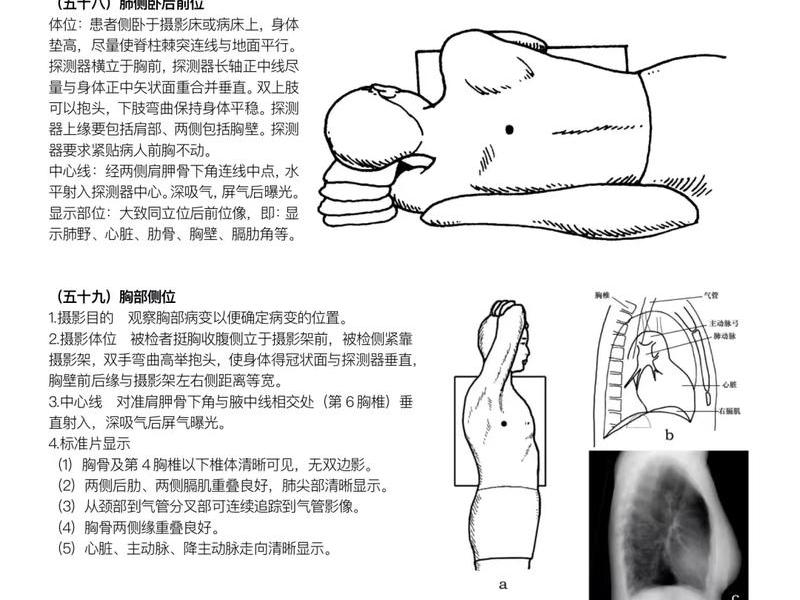 dr怎么操作方式、dr怎么用 dr怎么操作方式、dr怎么用