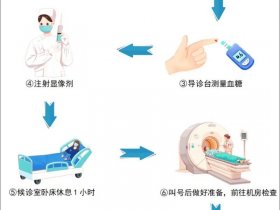 tap检测是什么意思 - tap检测怎么做
