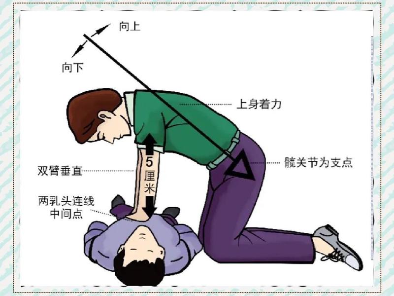 1分钟cpr教学动画(cpr操作教学视频) 1分钟cpr教学动画(cpr操作教学视频)