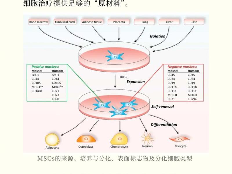 ucms;ucmsc是什么干细胞 ucms;ucmsc是什么干细胞