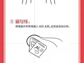 创建alias的主要步骤，创建alertdialog的步骤