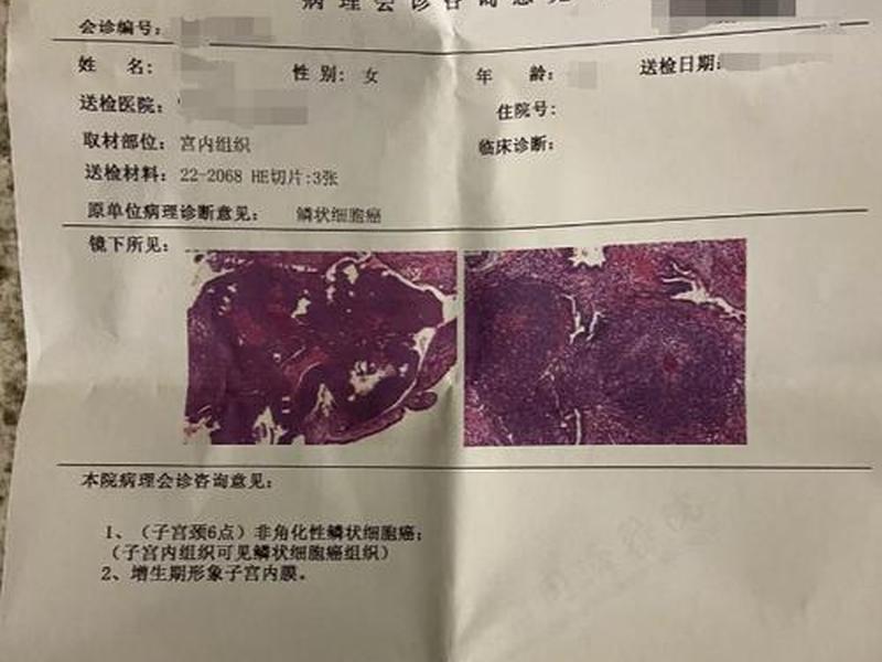 wopop 我婆婆70岁感染了hpv wopop 我婆婆70岁感染了hpv