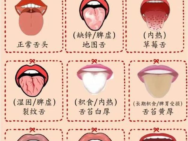 史上最全的舌诊图谱(史上最全的舌诊图谱,珍藏版!) 史上最全的舌诊图谱(史上最全的舌诊图谱,珍藏版!)