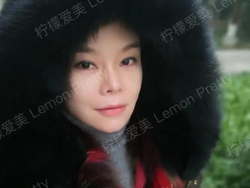 柠檬爱美怎么认证;柠檬爱美医生怎么认证 柠檬爱美怎么认证;柠檬爱美医生怎么认证