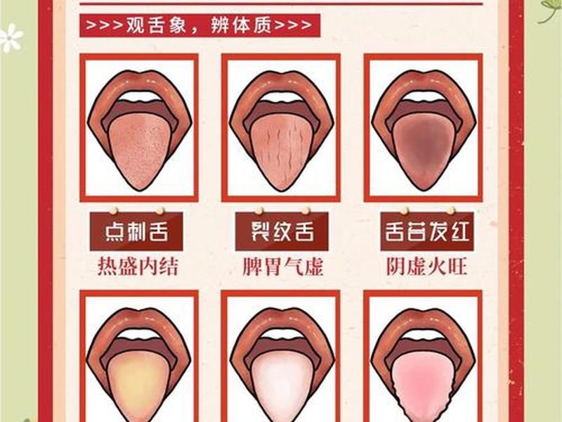 史上最全的舌诊图谱(史上最全的舌诊图谱,珍藏版!) 史上最全的舌诊图谱(史上最全的舌诊图谱,珍藏版!)