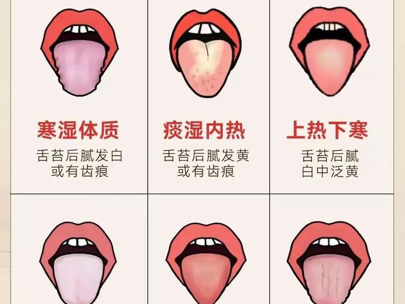 史上最全的舌诊图谱(史上最全的舌诊图谱,珍藏版!) 史上最全的舌诊图谱(史上最全的舌诊图谱,珍藏版!)