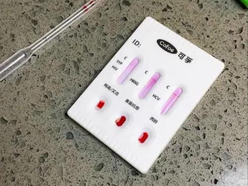 四合一检查是哪四合一、四合一检查具体是指什么 四合一检查是哪四合一、四合一检查具体是指什么