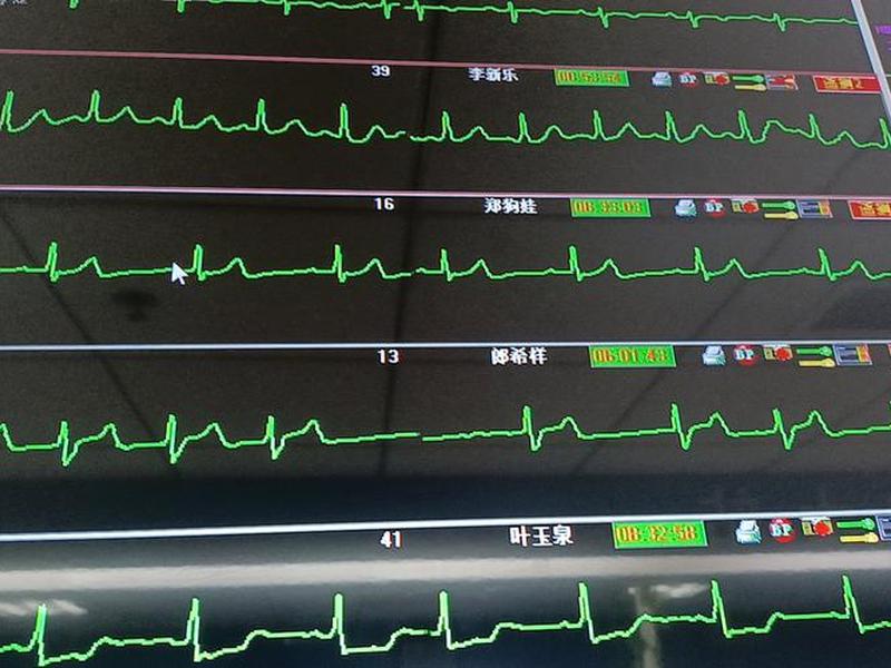 响应时间小于25ns - 响应时间25ms 响应时间小于25ns - 响应时间25ms