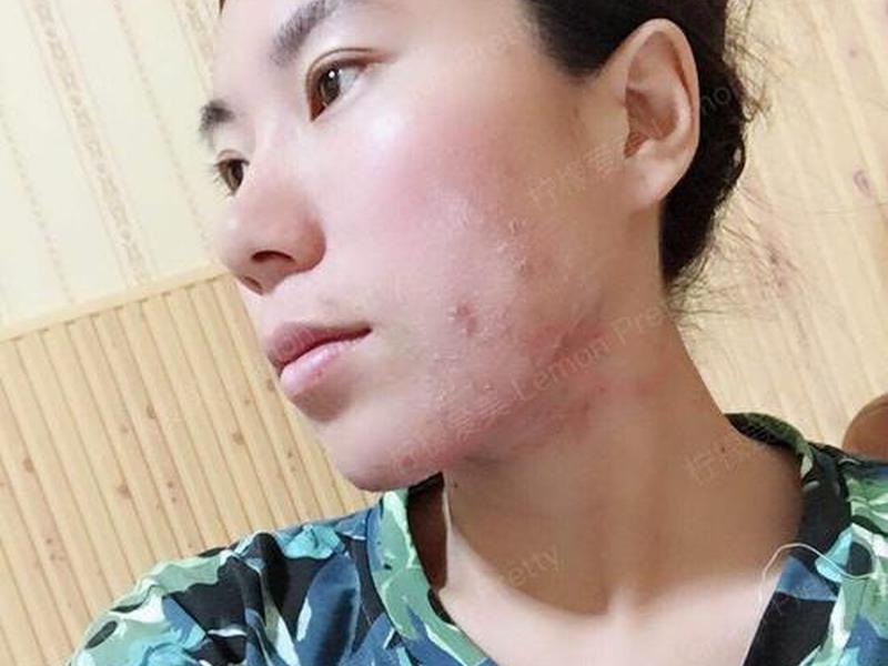 柠檬爱美真实姓名,柠檬爱美里面的案例是真实的吗 柠檬爱美真实姓名,柠檬爱美里面的案例是真实的吗