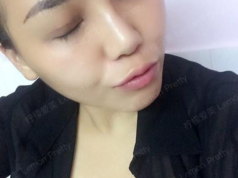柠檬爱美怎么认证;柠檬爱美医生怎么认证 柠檬爱美怎么认证;柠檬爱美医生怎么认证