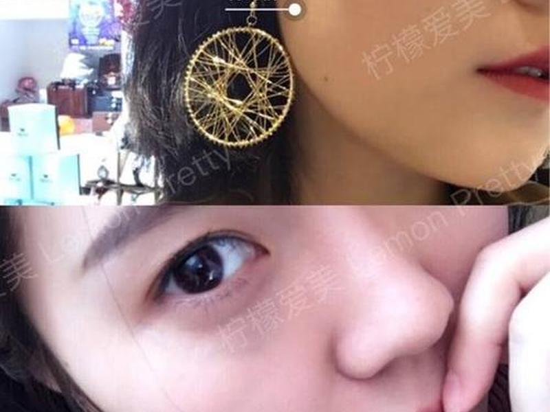 柠檬爱美在线使用，柠檬爱美在线咨询